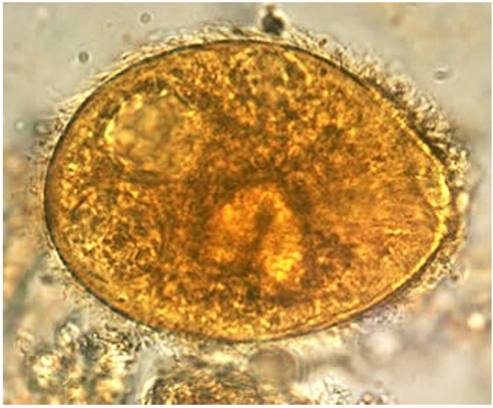 Figura 2. Balantidium coli: trofozoíto en una gota de heces, magnificado x 1000. Nótese los cilios visibles en la superficie celular(5). Imagen tomada de(5).