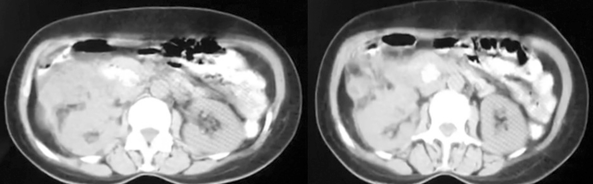 Figure 1. Dynamic liver CT. Image owned by the authors.